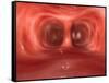 Microscopic View Inside the Human Lungs-null-Framed Stretched Canvas