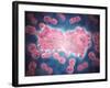 Microscopic View of a Group of Leukemia Cell-null-Framed Art Print