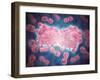 Microscopic View of a Group of Leukemia Cell-null-Framed Art Print