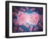 Microscopic View of a Group of Leukemia Cell-null-Framed Art Print