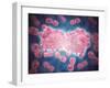 Microscopic View of a Group of Leukemia Cell-null-Framed Art Print