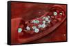 Microscopic View of Blood Clotting Inside the Artery-null-Framed Stretched Canvas
