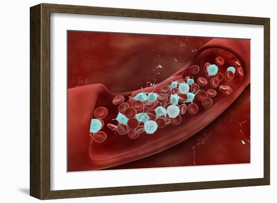 Microscopic View of Blood Clotting Inside the Artery-null-Framed Art Print