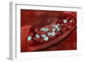 Microscopic View of Blood Clotting Inside the Artery-null-Framed Art Print