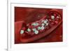 Microscopic View of Blood Clotting Inside the Artery-null-Framed Art Print