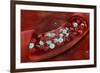 Microscopic View of Blood Clotting Inside the Artery-null-Framed Art Print