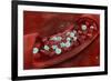 Microscopic View of Blood Clotting Inside the Artery-null-Framed Art Print