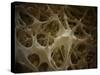 Microscopic View of Bone Fibre-null-Stretched Canvas