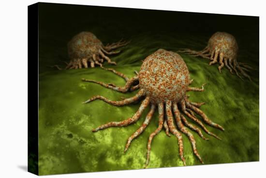 Microscopic View of Cancer Virus-null-Stretched Canvas