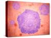 Microscopic View of Canine Parvovirus-null-Stretched Canvas