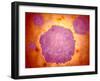 Microscopic View of Canine Parvovirus-null-Framed Art Print