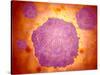 Microscopic View of Canine Parvovirus-null-Stretched Canvas