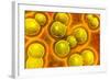 Microscopic View of Chlamydia-null-Framed Art Print