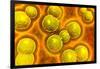 Microscopic View of Chlamydia-null-Framed Art Print