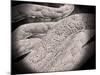 Microscopic View of Corncob Formation in Dental Plaque-null-Mounted Art Print