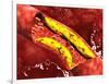 Microscopic View of Fat Plaque Inside the Artery-null-Framed Art Print