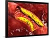 Microscopic View of Fat Plaque Inside the Artery-null-Framed Art Print