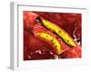 Microscopic View of Fat Plaque Inside the Artery-null-Framed Art Print