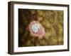 Microscopic View of Giardiasis-null-Framed Art Print