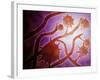 Microscopic View of Histoplasmosis-null-Framed Art Print