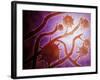 Microscopic View of Histoplasmosis-null-Framed Art Print