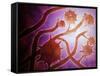 Microscopic View of Histoplasmosis-null-Framed Stretched Canvas