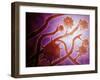 Microscopic View of Histoplasmosis-null-Framed Art Print