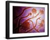 Microscopic View of Histoplasmosis-null-Framed Art Print