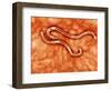 Microscopic View of Hookworm-null-Framed Art Print