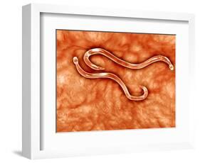 Microscopic View of Hookworm-null-Framed Art Print