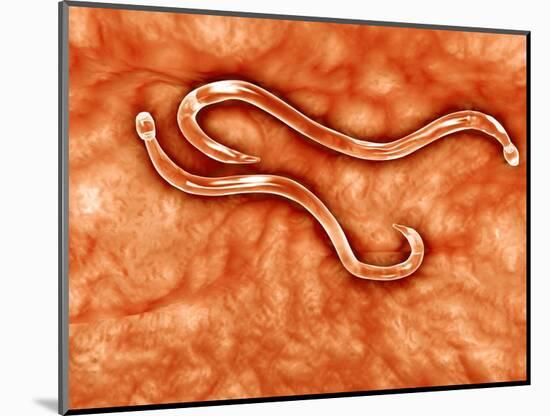 Microscopic View of Hookworm-null-Mounted Art Print