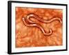 Microscopic View of Hookworm-null-Framed Art Print