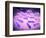 Microscopic View of Listeria Monocytogenes-null-Framed Art Print