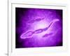 Microscopic View of Male Sperm Cells-null-Framed Art Print