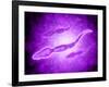 Microscopic View of Male Sperm Cells-null-Framed Art Print