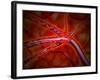 Microscopic View of Medicine Being Injected Inside the Artery-null-Framed Art Print