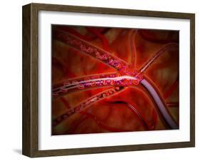 Microscopic View of Medicine Being Injected Inside the Artery-null-Framed Art Print