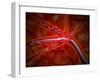 Microscopic View of Medicine Being Injected Inside the Artery-null-Framed Art Print