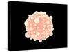 Microscopic View of Pancreatic Cancer Cell-null-Stretched Canvas