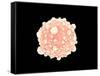 Microscopic View of Pancreatic Cancer Cell-null-Framed Stretched Canvas
