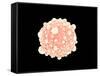 Microscopic View of Pancreatic Cancer Cell-null-Framed Stretched Canvas