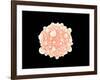 Microscopic View of Pancreatic Cancer Cell-null-Framed Art Print