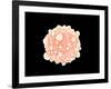 Microscopic View of Pancreatic Cancer Cell-null-Framed Art Print