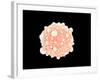 Microscopic View of Pancreatic Cancer Cell-null-Framed Art Print