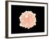 Microscopic View of Pancreatic Cancer Cell-null-Framed Art Print
