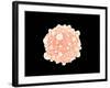 Microscopic View of Pancreatic Cancer Cell-null-Framed Art Print