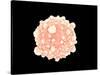 Microscopic View of Pancreatic Cancer Cell-null-Stretched Canvas