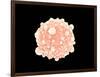 Microscopic View of Pancreatic Cancer Cell-null-Framed Art Print