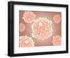 Microscopic View of Pancreatic Cancer Cell-null-Framed Art Print