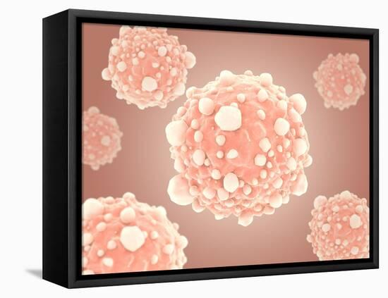 Microscopic View of Pancreatic Cancer Cell-null-Framed Stretched Canvas